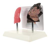 Modèle Pulmonaire Anatomique Comparatif Pathologique en PVC | Comparaison Fumeur et Sain, Rendu Réaliste, Usage en Physiologie et Anatomie, pour Étudiants