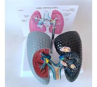 Modèle pulmonaire humain pour l'enseignement en classe - Comparaison du tabagisme et des poumons sains pour la démonstration de pathologie respiratoire viscérale