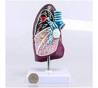 Modèle pulmonaire humain - Véritable modèle anatomique 2:3 grandeur nature pour l'enseignement des poumons malades pour les sciences en classe et les études médicales, communiquer avec les patients