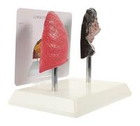 Modèle Pulmonaire Médical Réaliste en PVC pour L'enseignement Anatomique | Comparaison Poumon Sain et Pathologique, Usage en Physiologie, pour Étudiants, Format Pédagogique