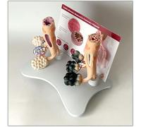 Modèle pulmonaire pour fumeurs Modèle pulmonaire sain Modèle alvéolaire pour la santé pulmonaire du tabagisme humain avec caractéristiques pathologiques et structure anatomique précise pour les effets