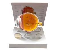 Modèle réaliste d'anatomie de l'œil humain - Modèle d'anatomie oculaire - Outil éducatif pathologique - Modèle d'anatomie oculaire