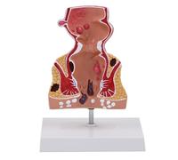 Modèle rectal humain pour l'école de laboratoire Pathologies de l'anatomie Instrument d'enseignement médical Pathologies de l'enseignement médical