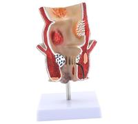 Modèle rectal humain pour l'enseignement de l'anatomie Aide à lutter contre les pathologies humaines pratiques du modèle rectuel, école scolaire, pathologies humaines du modèle rectuel, modèle rectal