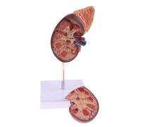 Modèle rénal nsxayiwe, modèle d'anatomie rénale Humaine avec Base, divisé en 2 Parties montrant la Structure Interne Une réplique Normale d'anatomie Humaine pour l'enseignement