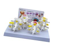 Modèle Squelette Humain Pour L'anatomie Lumbar Spine Lésions 4 Étages Modèle Comparatif Modèle Soins Infirmiers Du Modèle Vertèbre Lombaire