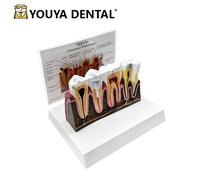 Modèle Standard D'anatomie De Structure Dentaire,Technicien Dentaire Wagmodel,Étudiant Étudiant Étudiant,Fuchsia,Démonstration De Pratique