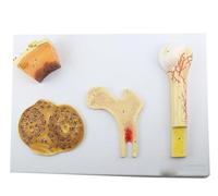 Modèle structure osseuse Cancellous Figure compacte avec détails Humain | Anatomie Périostéum structurel en 4 parties, vaisseaux, os épongé et compact, système Haversian, modèle humain