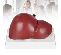 Modèles de Foie Anatomiques, Lot de 3 Foies Pathologiques Échelle 1:1,A | Compare Foie Normal, Foie Gras Non Alcoolique et Alcoolique pour l’Enseignement de l’Anatomie,A
