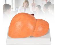 Modèles de Foie Anatomiques, Lot de 3 Foies Pathologiques Échelle 1:1,C | Compare Foie Normal, Foie Gras Non Alcoolique et Alcoolique pour l’Enseignement de l’Anatomie,C