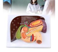 Modèles de structures gastro-intestinales hépato-biliaires-pancréatiques-duodénales, modèle pancréatique-duodénal pour l'aide à la formation médicale