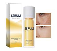Moisturising Lotion | 30ml Hydrating Light Moisturiser Skin Care | Natural Facial Moisturizer for Daily Morning Night Daytime Travel Home Spa Massage Fall Winter Summer Pre-Sun
