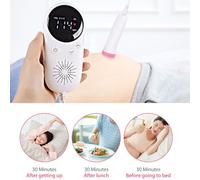 Moniteur De Rythme Cardiaque Pour Bébé, 2.5mhz, Détecteur De Fréquence Cardiaque Prénatale, Moniteur De Santé F¿Tale Pour Femmes Enceintes, Pas De Radiation