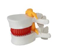 mophrati Outil d'enseignement médical, modèle réaliste de vertèbres lombaires pour Un Apprentissage Pratique, modèle d'accessoires médicaux faciles à Nettoyer