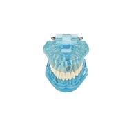 Moule d'enseignement Dentaire Modèle d'anatomie Modèle Dentaire Transparent Maladie Dents Transparent Dentiste Standard Maladie Amovible Pathologie Enseignement