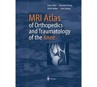 Mri Atlas Of Orthopedics And Traumatology Of The Knee