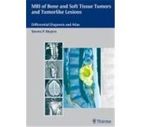 MRI of Bone and Soft Tissue Tumors and Tumorlike Lesions Steven P. Meyers (Auteur)