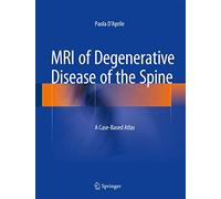 MRI of Degenerative Disease of the Spine: A Case-based Atlas