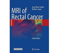 Mri Of Rectal Cancer