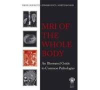 Mri Of The Whole Body