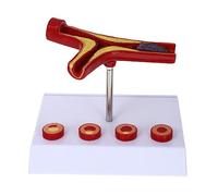 MUELODSIC Modèle Anatomique Vasculaire Cardiovasculaire PVC pour Enseignement Scolaire et Médical Démonstration Claire de Anatomie et Pathologies