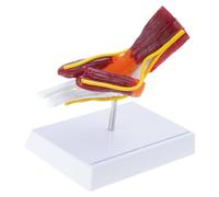 Muscles Réalistes L'articulation Du Coude Avec Détails Des Muscles Des Nerfs Pour Les Milieux Cliniques Enseignement Recherche Rapport Conférence