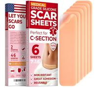 MYHELP Différence visible sur les cicatrices : nos feuilles en silicone de qualité médicale sont conçues pour réduire considérablement l'apparence des cicatrices post-chirurgicales