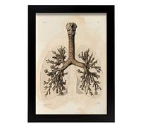 Nacnic Affiche Bronchien. Illustrations décoratives sur l'anatomie et la médecine dans Un Style Vintage. Conception et décoration intérieure. Taille A3, Pas de Cadre.