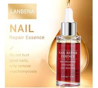 Nail Repair 15 ML Naturel Puissant Nail Repair Essence Anti-fongus Nail Treatment Solution Efficace de Réparation