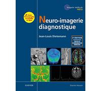 Neuro-imagerie diagnostique