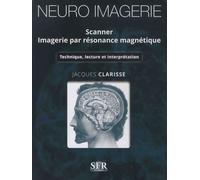 Neuro Imagerie - Scanner - Imagerie Par Résonance Magnétique - Technique, Lecture Et Interprétation