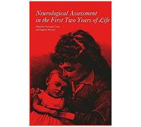 Neurological Assessment In The First Two Years Of Life