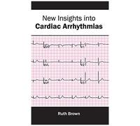 New Insights Into Cardiac Arrhythmias
