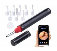 Newgen Medicals Nettoyeur d'oreille connecté avec caméra Full HD et boitier en aluminium