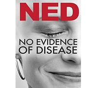No Evidence Of Disease