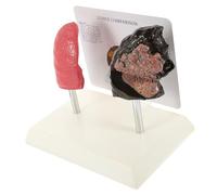 NOLITOY Modèle Anatomique Pulmonaire Réaliste pour Enseignement Modèle de Poumon Détaillé Outil Pédagogique pour Étudiants Médecine et Sensibilisation