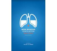 Non-Invasive Ventilation Made Simple