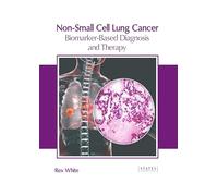 Non-Small Cell Lung Cancer: Biomarker-Based Diagnosis and Therapy