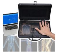 NOOGRRFA Analyseur Corporel par Résonance Magnétique Quantique, Bilan De Santé Physique, 54 Rapports, Tests Rapides Et Précis, Facile À Utiliser, Petit Et Portable, Clé USB Incluse