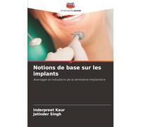 Notions de base sur les implants: Avantages et indications de la dentisterie implantaire