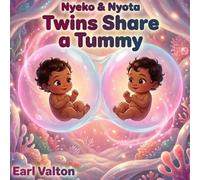 Nyeko & Nyota: Twins Share a Tummy