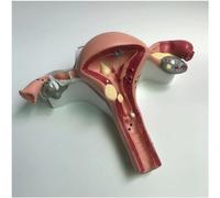 NZPOST Modèle Anatomique du Corps Humain, modèle d'utérus féminin, modèles pédagogiques, modèle Anatomique d'utérus pathologique, Anatomie des Organes Humains