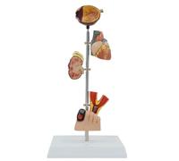 NZPOST Modèle d'organe diabétique Modèle de gangrène et de thrombose diabétiques Modèle d'affichage des complications du diabète pour l'hôpital