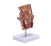 Oaqmvgin Modèle d'anatomie rectale pour outils d'éducation médicale | Modèle en PVC moulé par injection avec texture réaliste, et facile à démonter pour l'enseignement dans les cliniques et les