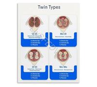 Obstetrics Placentation of Twins Chart Informative Poster Educational Wall Art Canvas Print for Hospital Office Living Room Bedroom Decor(Unframed,08x12inch(20x30cm))