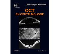 OCT en ophtalmologie