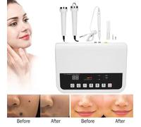 OMABETA Machine de suppression des taches de rousseur par ultrasons et de soins du visage - Maison Salon