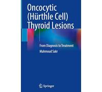 Oncocytic Hürthle Cell Thyroid Lesions: From Diagnosis to Treatment