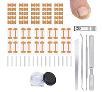 Ongle Incarné Kit,Kit De Correction D'ongles Incarnés,Patch Correcteur D'Ongles D'Orteils,avec bandes correctrices, lève-ongles et lime,outils de pédicure professionnels,Soin Des Ongles