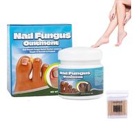 Onguent rapide contre les mycoses des ongles, action rapide pour les ongles des pieds et des mains, soin quotidien doux pour les ongles des pieds et des mains, renforce et restaure (1 pièce)